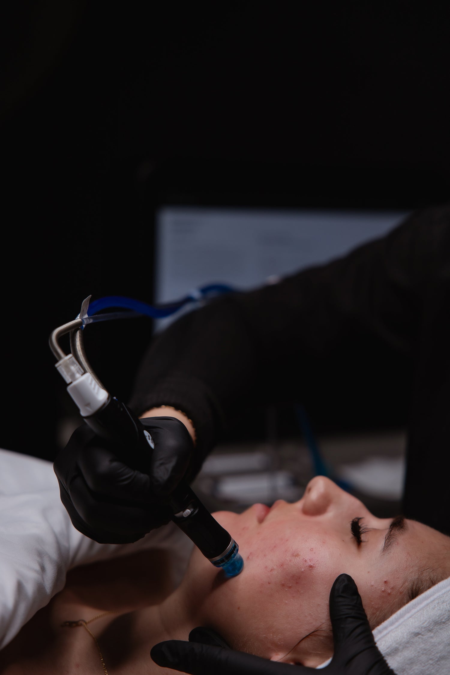 HydraFacial