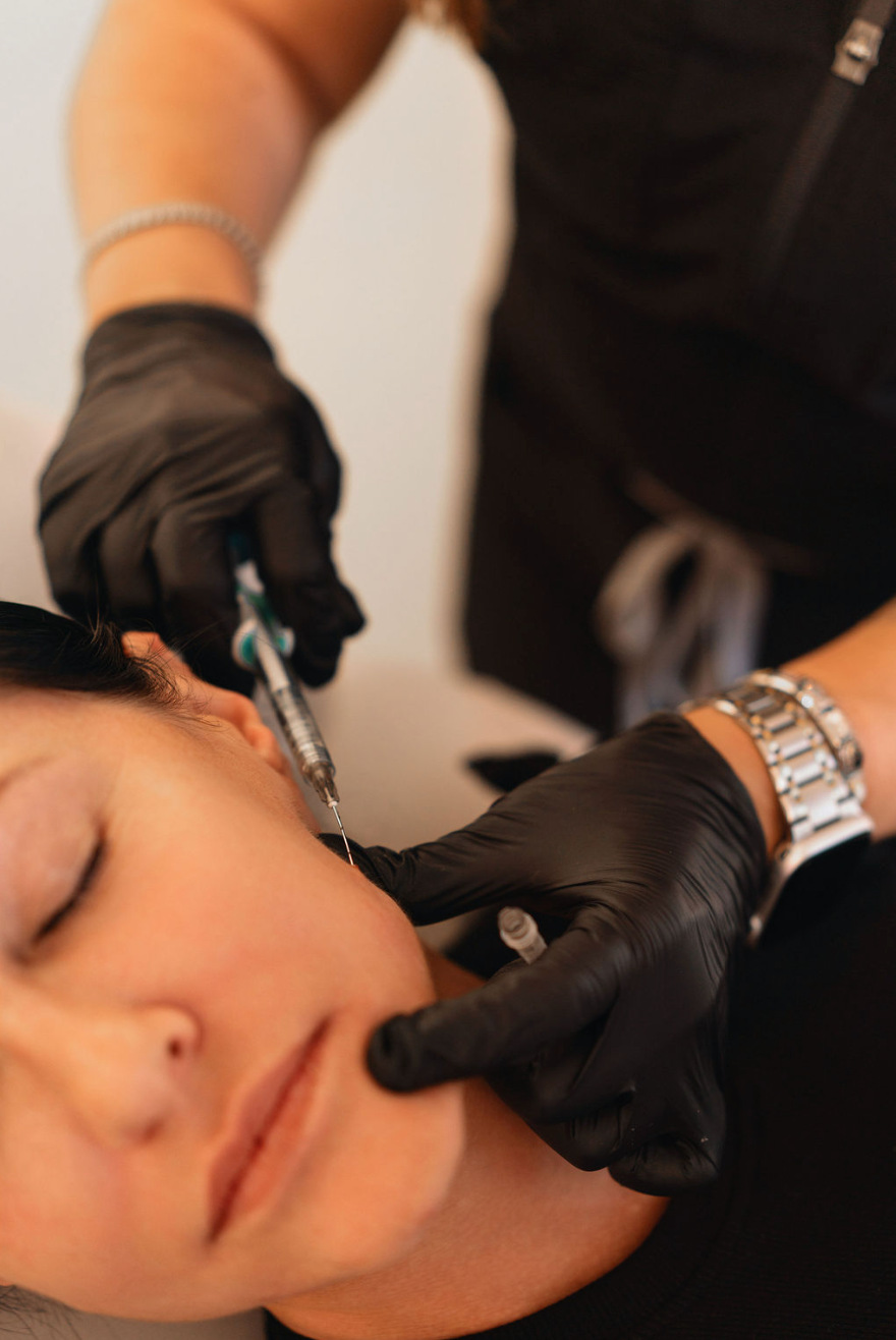 Dermal Filler