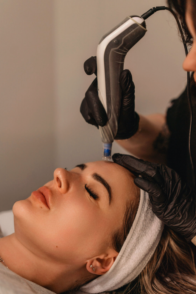 MICRONEEDLING