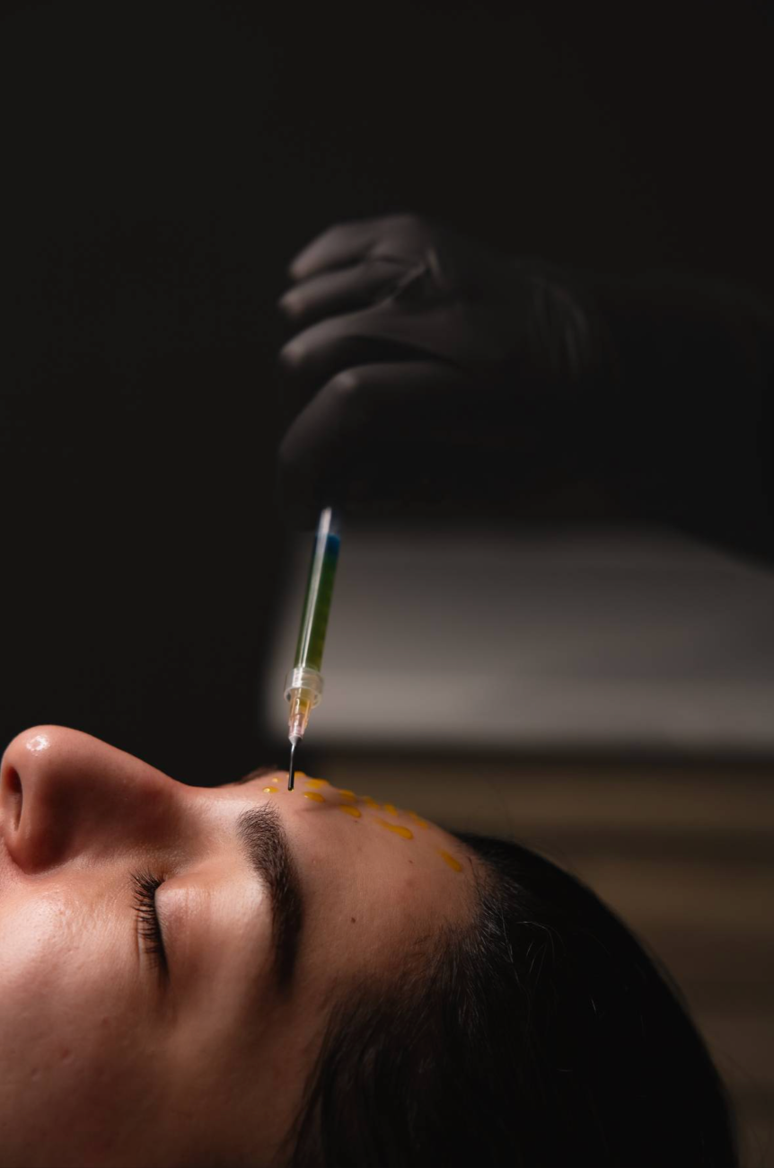 Chemical Peels