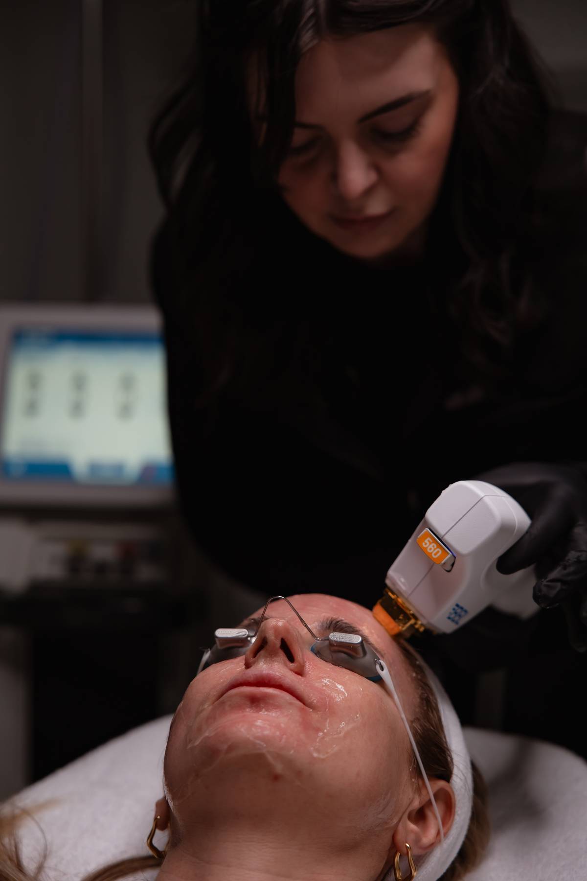 Client wearing protective eye shields receiving a BBL Forever Young BroadBand Light treatment on the face at KOZA Skin Clinic, Port Coquitlam, Tri-Cities BC