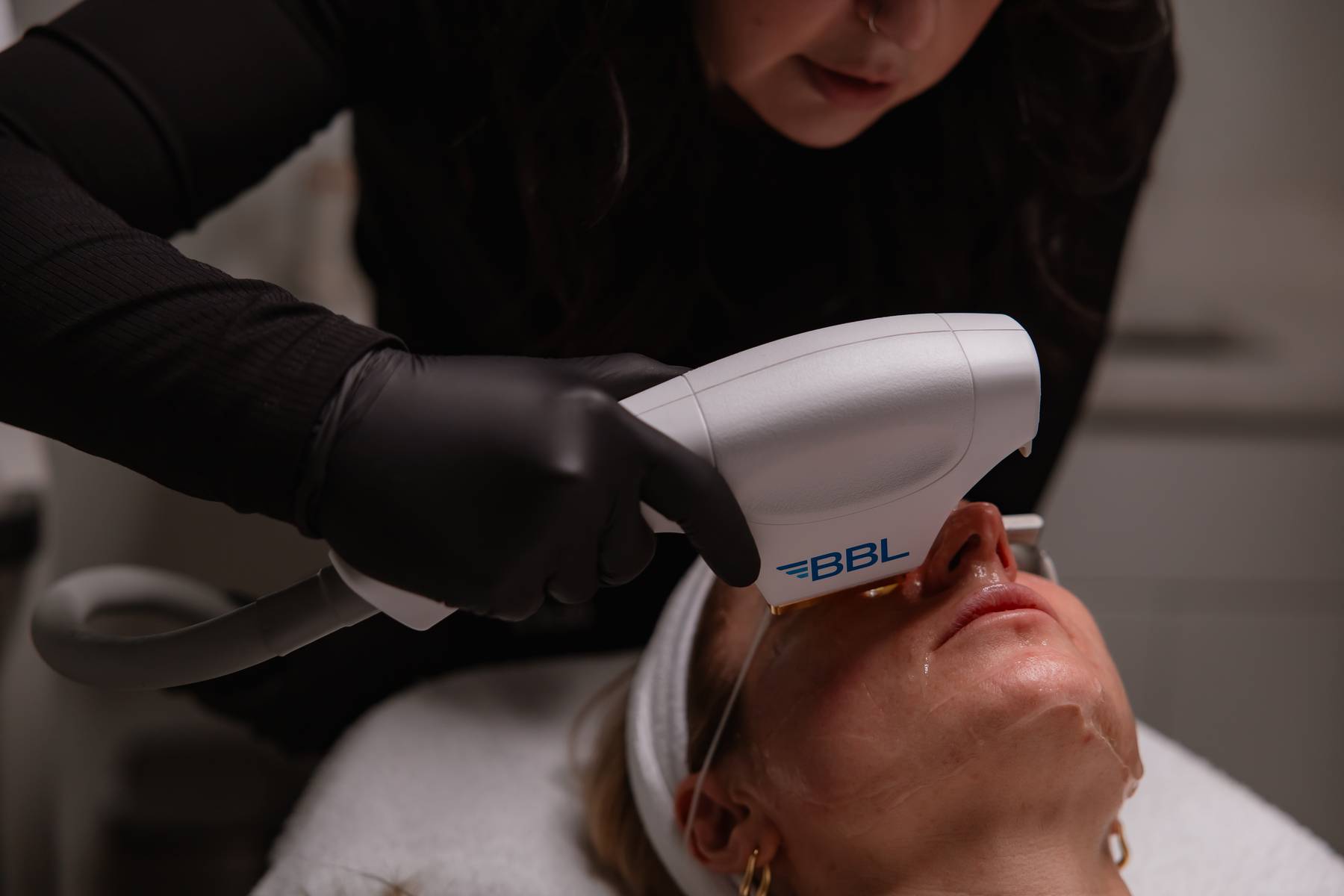BBL photofacial handpiece applied to a client's face and jawline during a treatment at KOZA Skin Clinic, Port Coquitlam, Tri-Cities BC.