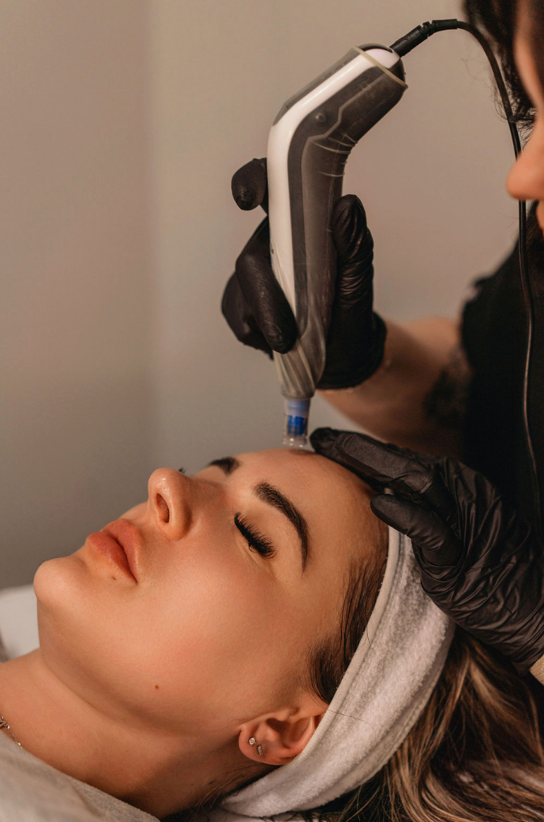 Clinician using a DP4 microneedling pen on a reclining client's forehead during a facial treatment at KOZA Skin Clinic, Port Coquitlam, Tri-Cities BC