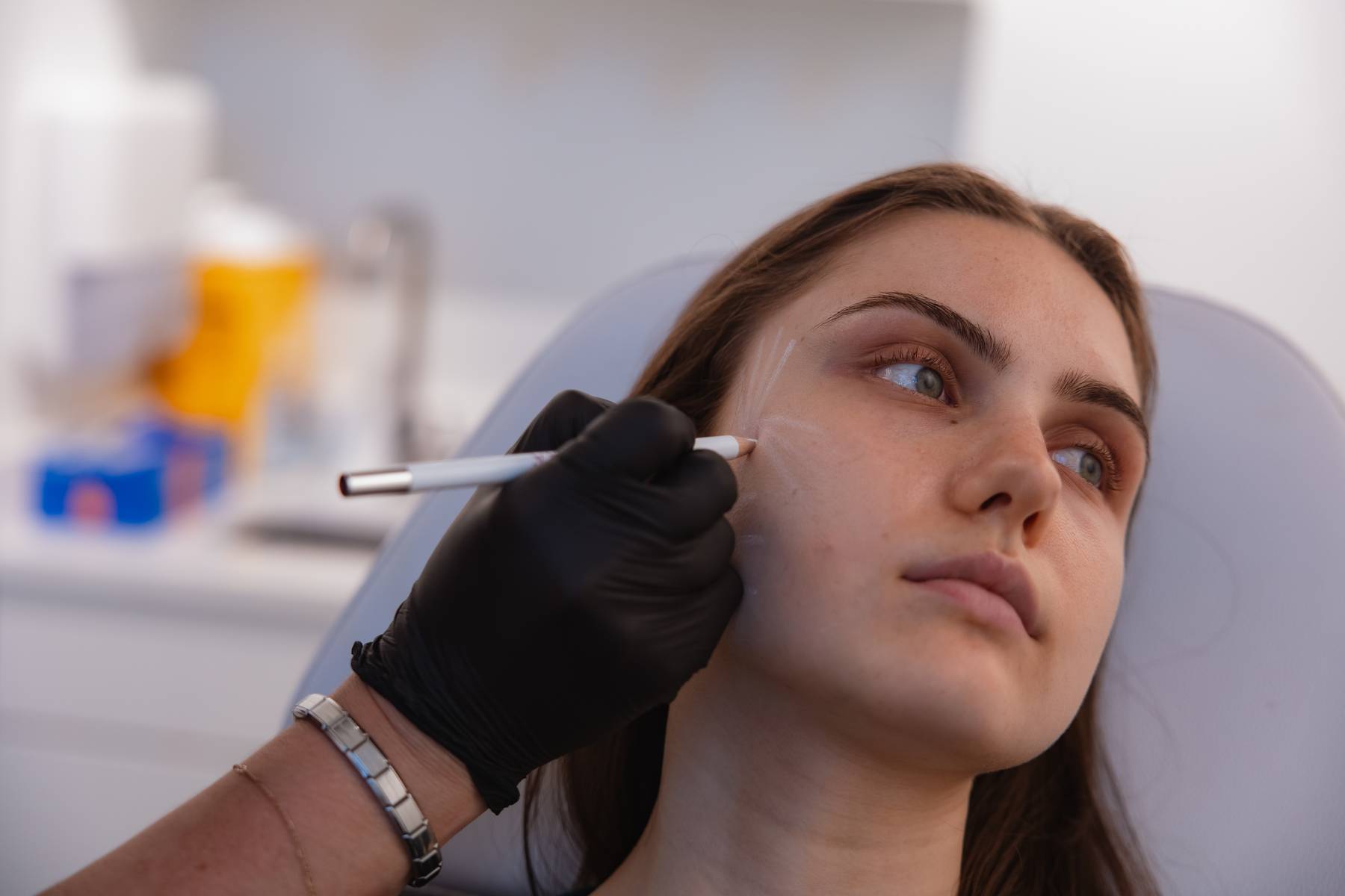 Clinician mapping a client's cheek with a marking pen before a dermal filler treatment at KOZA Skin Clinic, Port Coquitlam, Tri-Cities BC