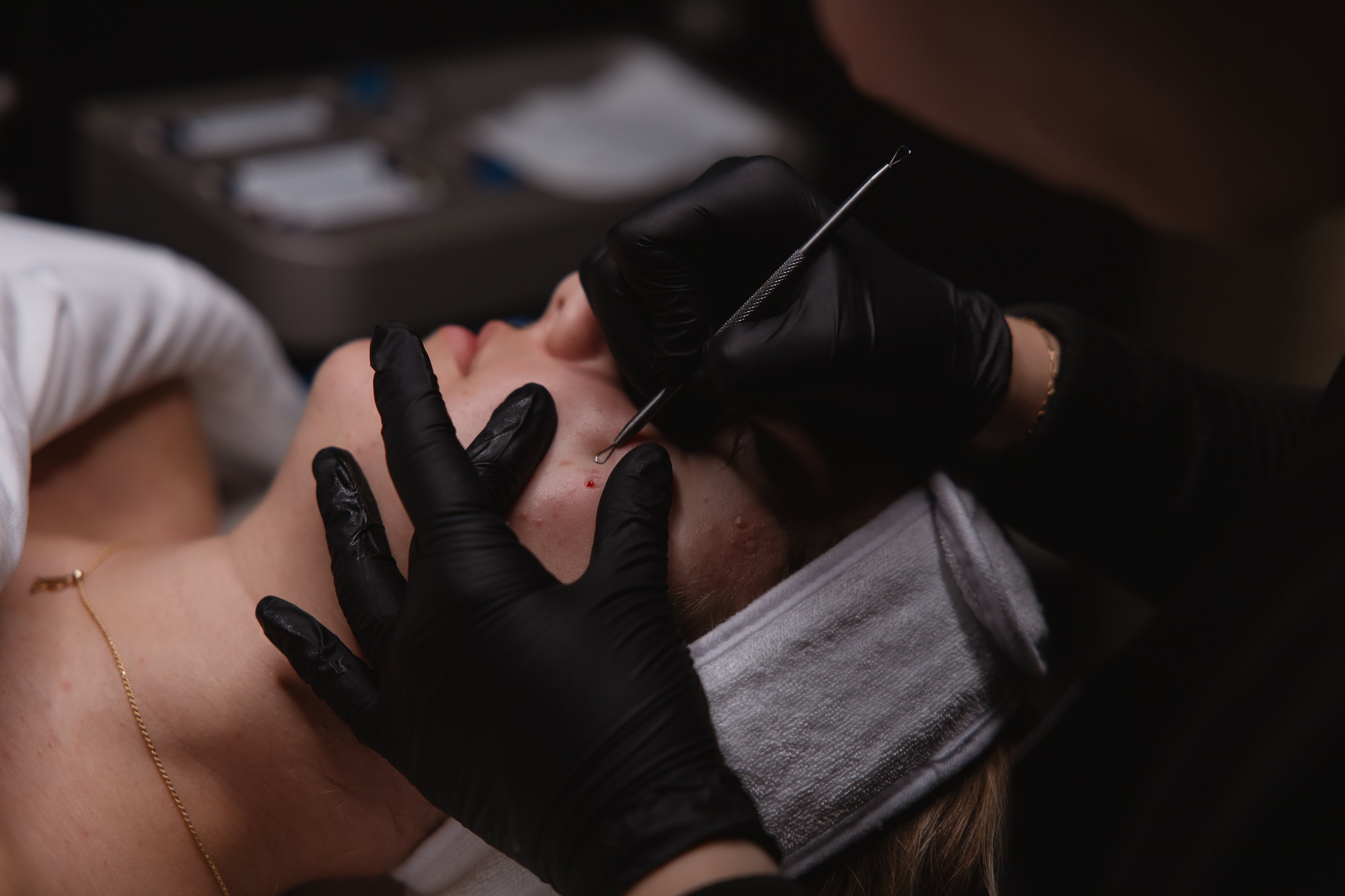 Esthetician performing facial extractions on a client during a treatment at KOZA Skin Clinic, Port Coquitlam, Tri-Cities BC.
