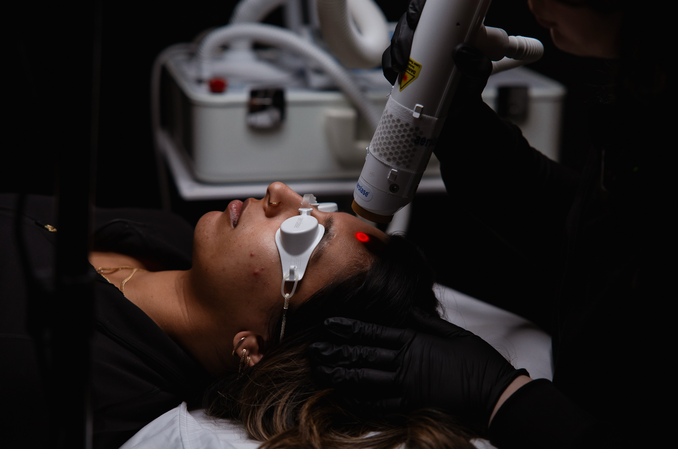 Client wearing protective eye shields receiving a laser facial treatment with a handheld device at KOZA Skin Clinic, Port Coquitlam, Tri-Cities BC