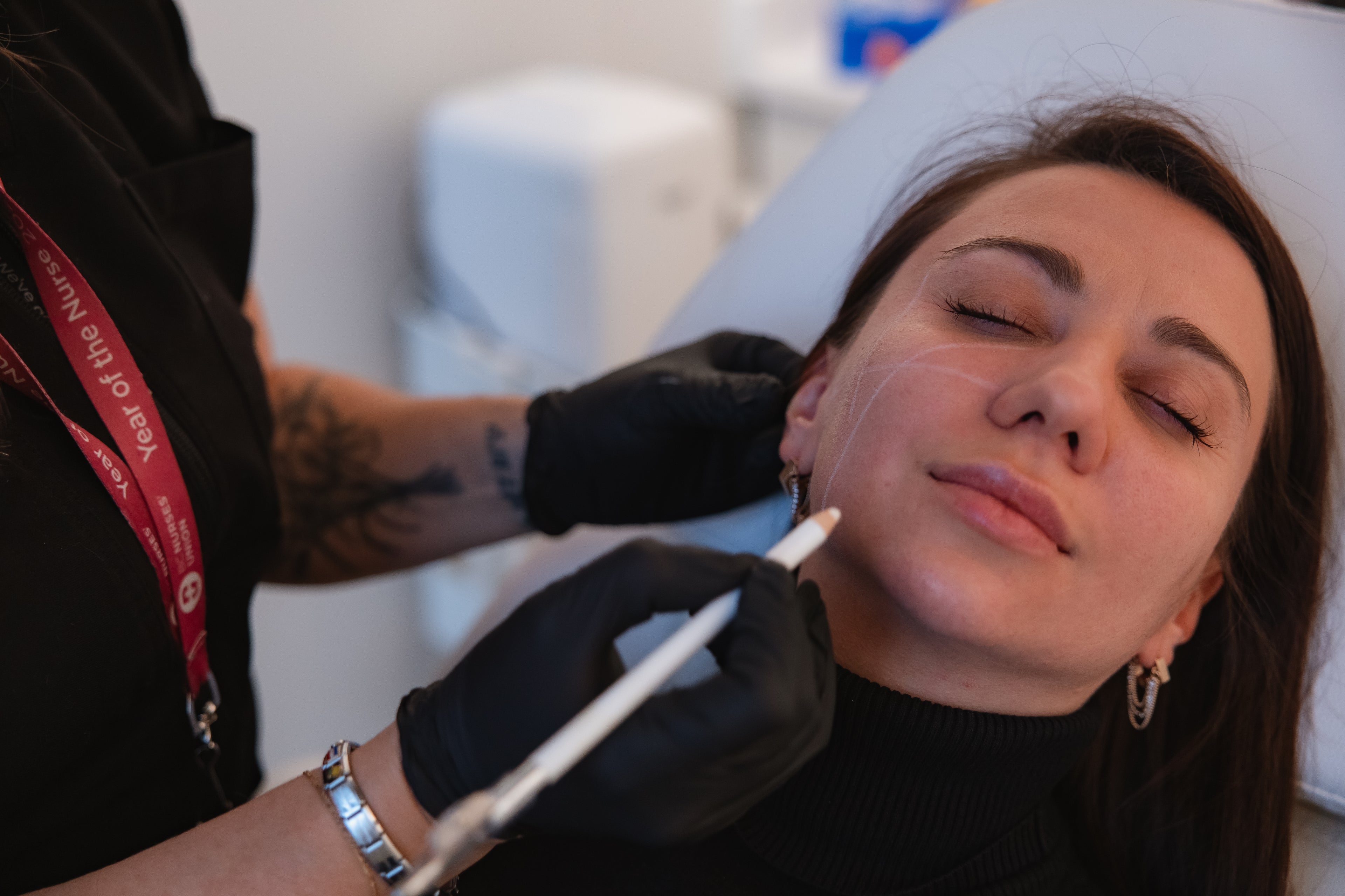 Lip filler treatment by a clinician at KOZA Skin Clinic in Port Coquitlam, Tri-Cities BC.