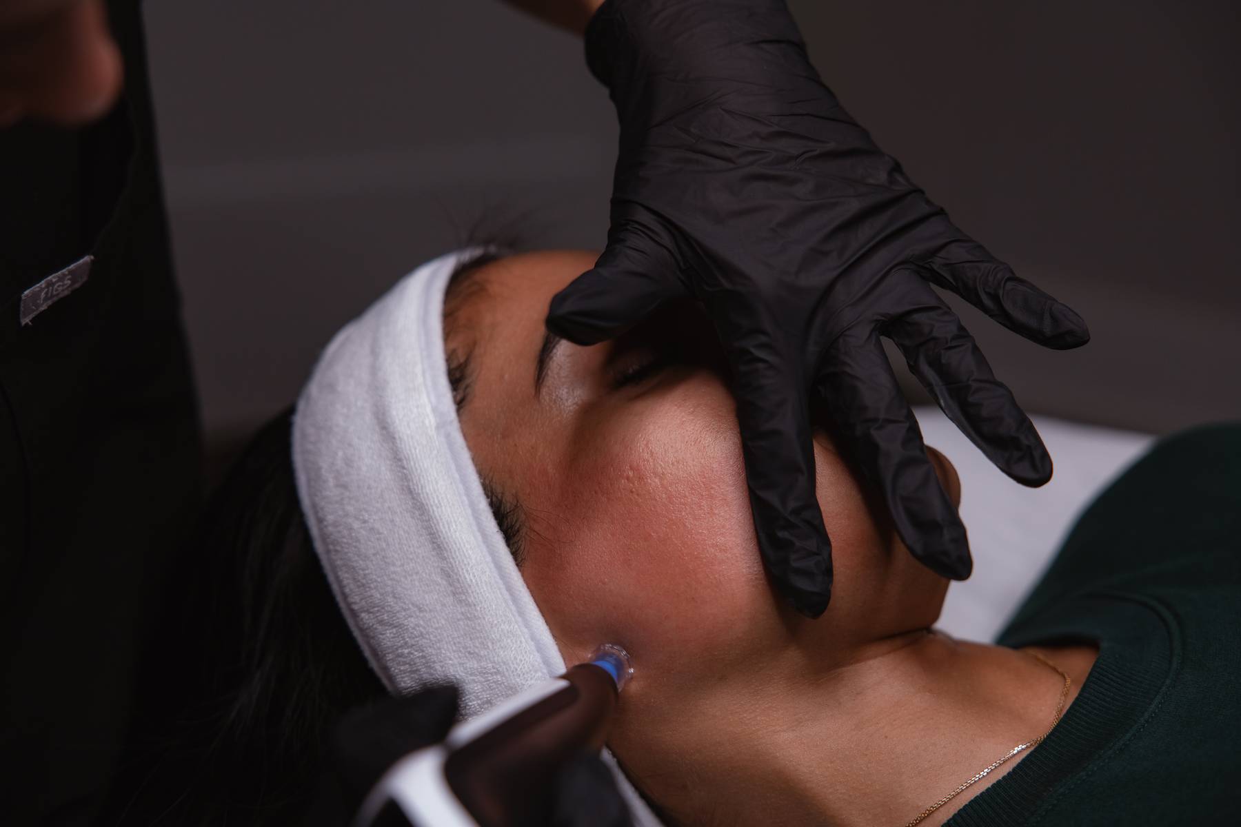 Clinician steadying a reclining client's face during a microneedling facial treatment with a headband and eye protection at KOZA Skin Clinic, Port Coquitlam, Tri-Cities BC