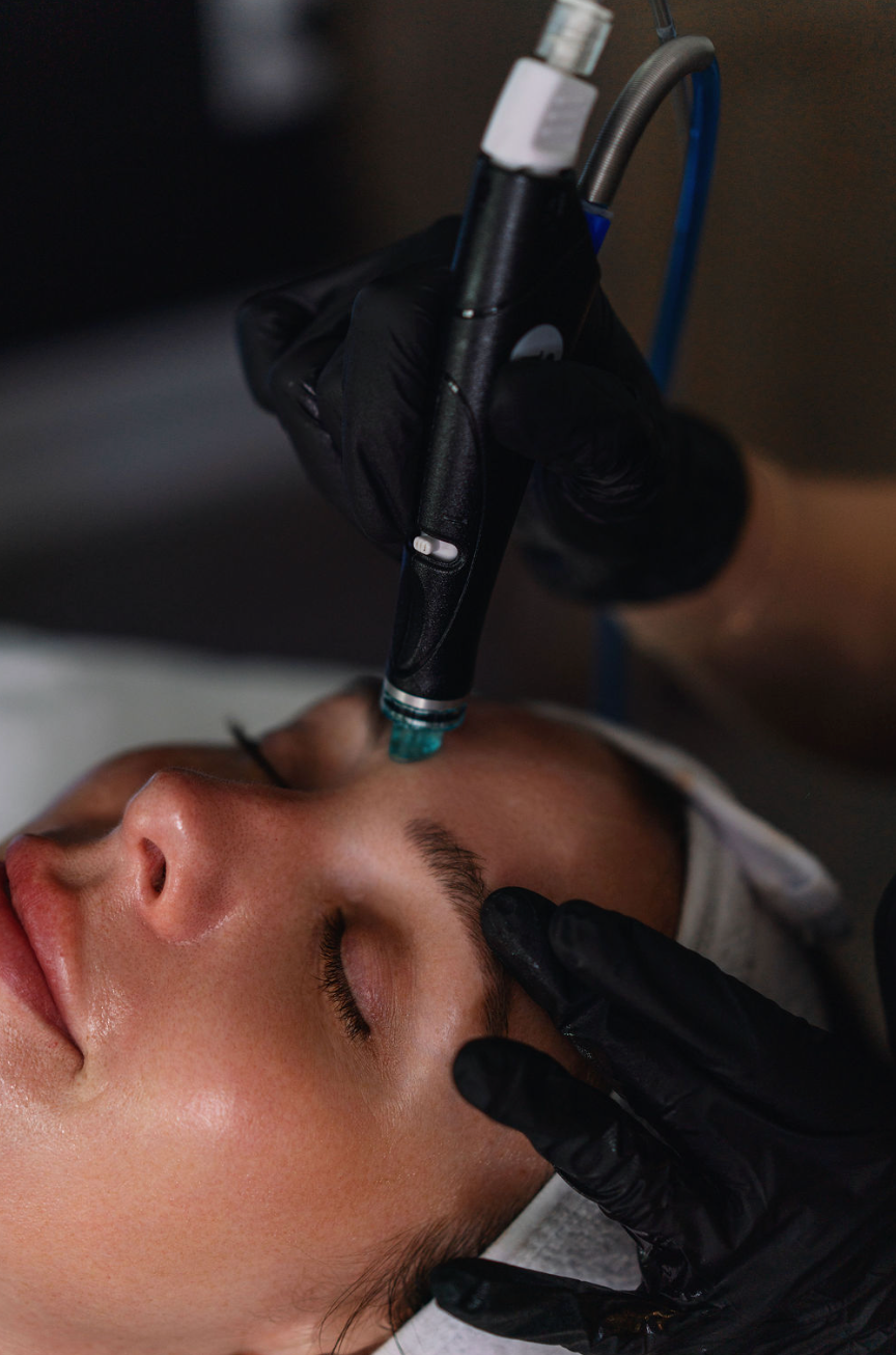Clinician using a microneedling pen on a reclining client's forehead during a facial treatment at KOZA Skin Clinic, Port Coquitlam, Tri-Cities BC