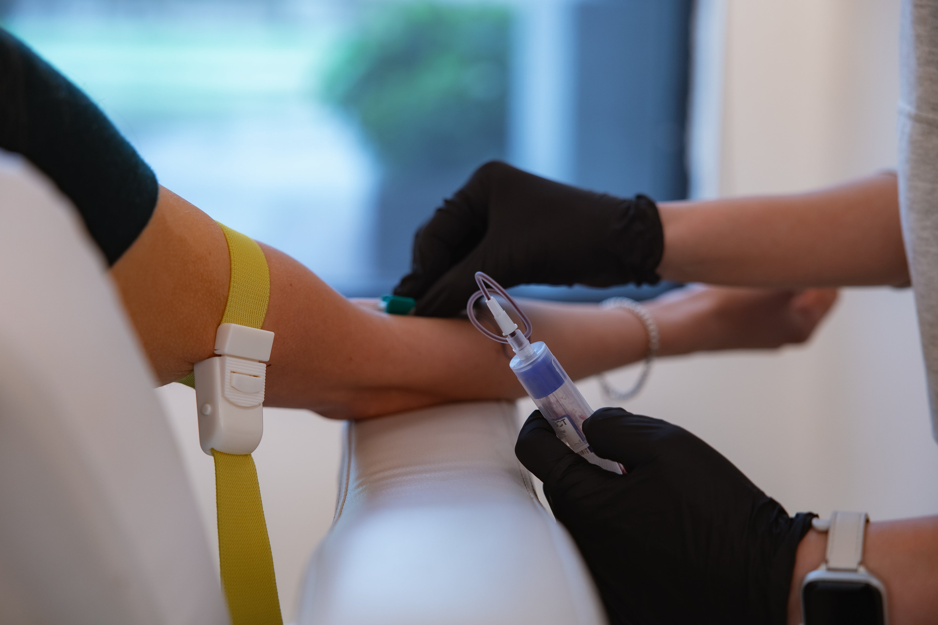 Blood draw from the arm for a PRP hair restoration treatment at KOZA Skin Clinic, Port Coquitlam, Tri-Cities BC.
