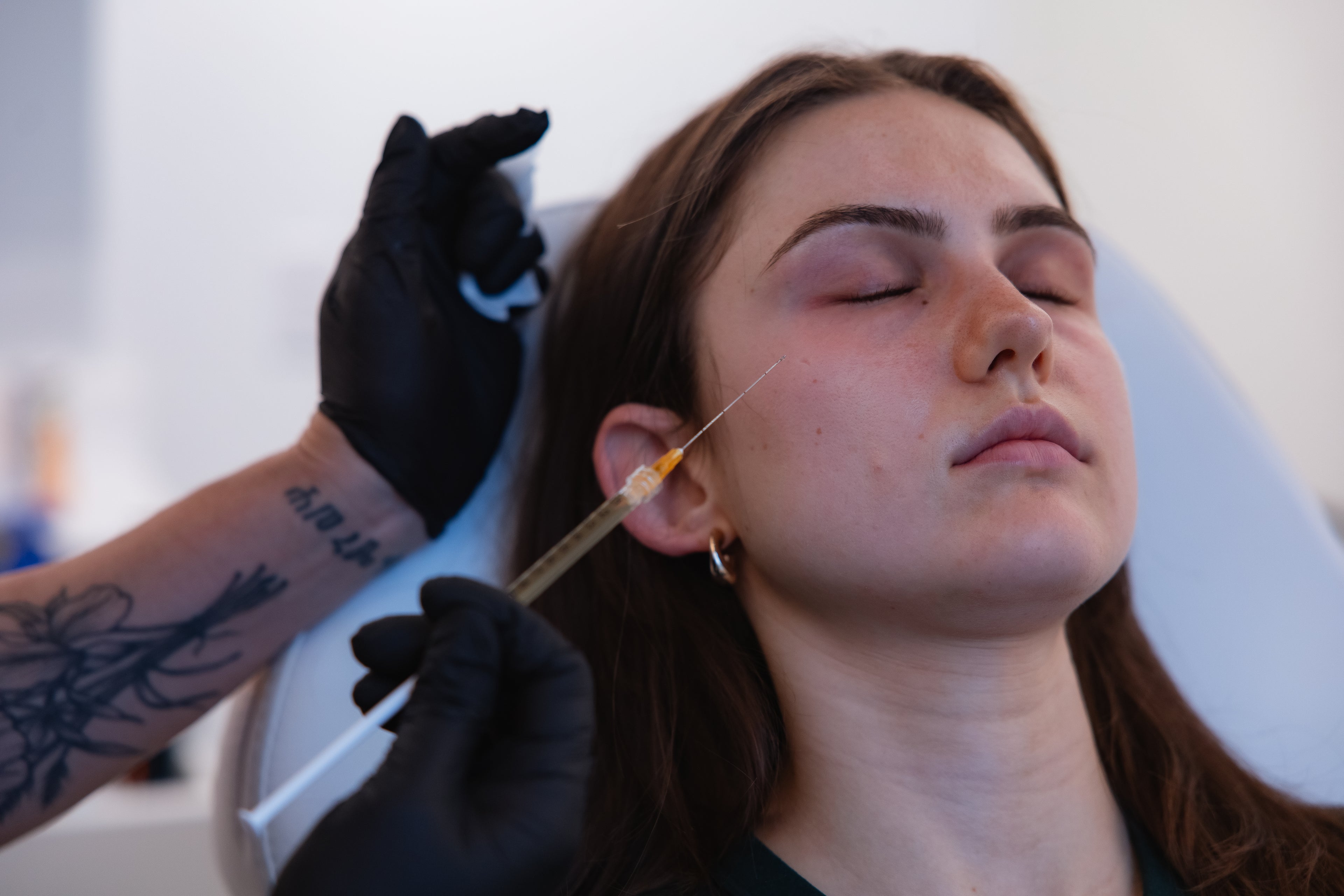 Client receiving a PRP and PRF facial injection treatment at KOZA Skin Clinic, Port Coquitlam, Tri-Cities BC.