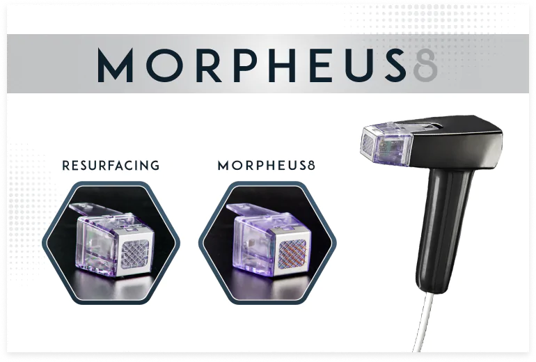 Morpheus8 & Resurfacing by KOZA Skin Clinic