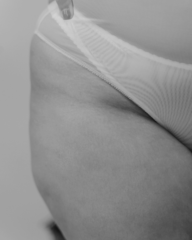 Cellulite treatment by KOZA Skin Clinic