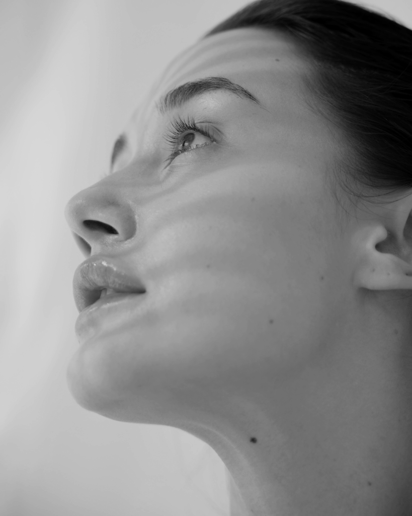Double Chin Submental Fullness treatment by KOZA Skin Clinic