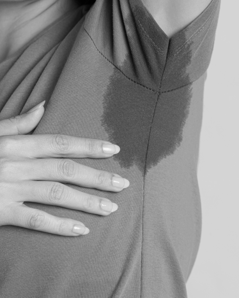 Excessive Sweating treatment by KOZA Skin Clinic