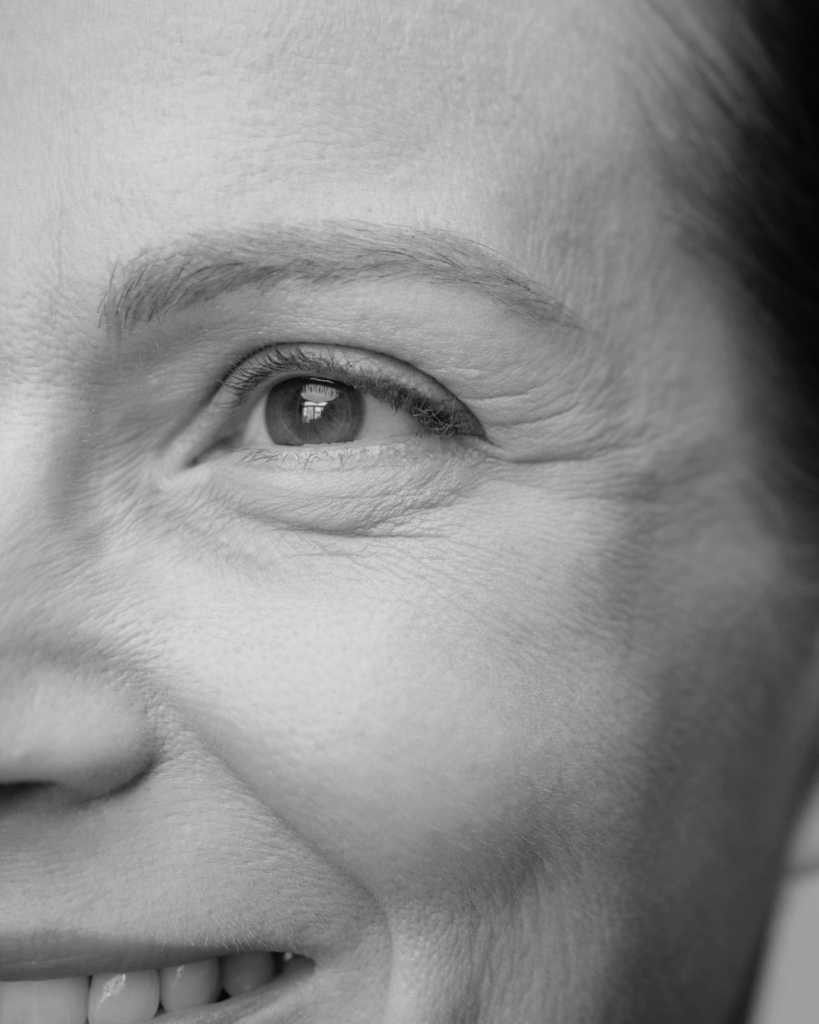 Fine Lines and Wrinkles by KOZA Skin Clinic