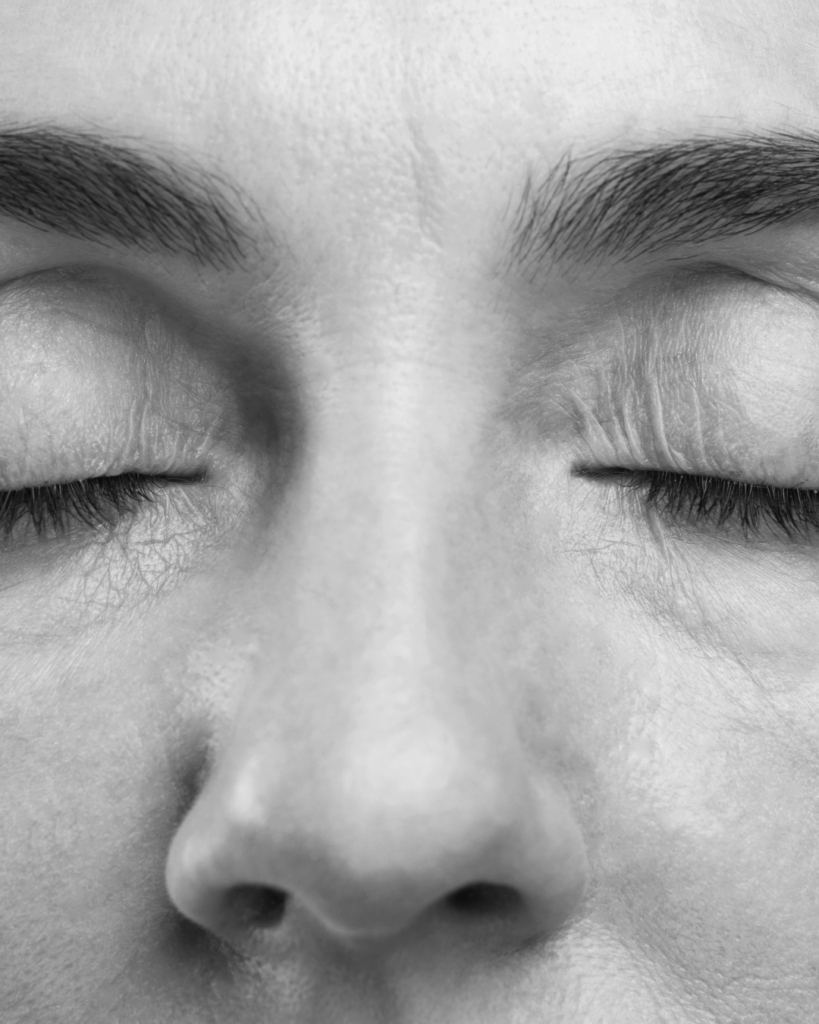 Tired Eyes, Dark Circles, Eye Bags treatment by KOZA Skin Clinic