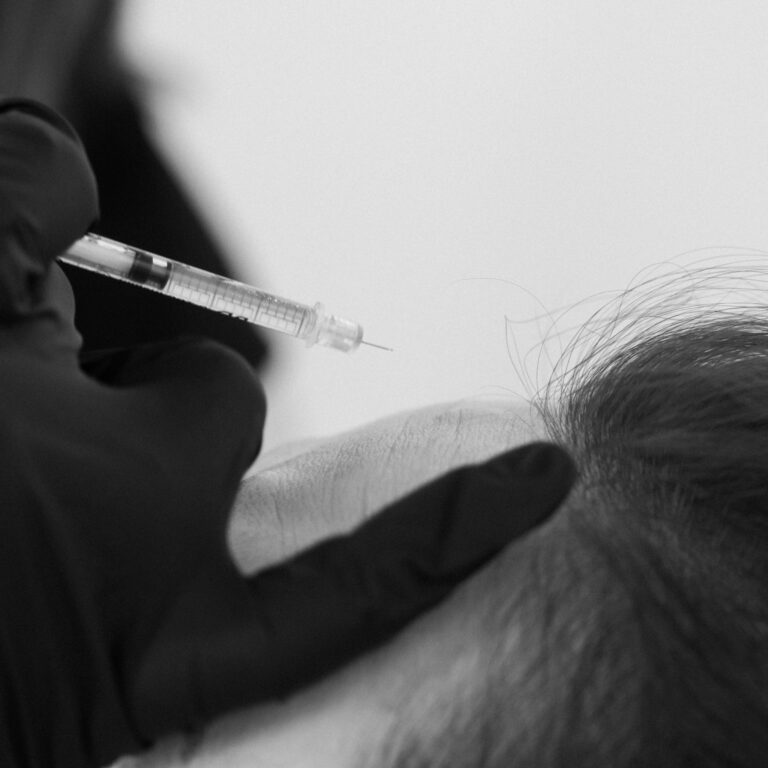 Botox Dysport Nuceiva Port Coquitlam Port Moody Vancouver KOZA Skin Clinic