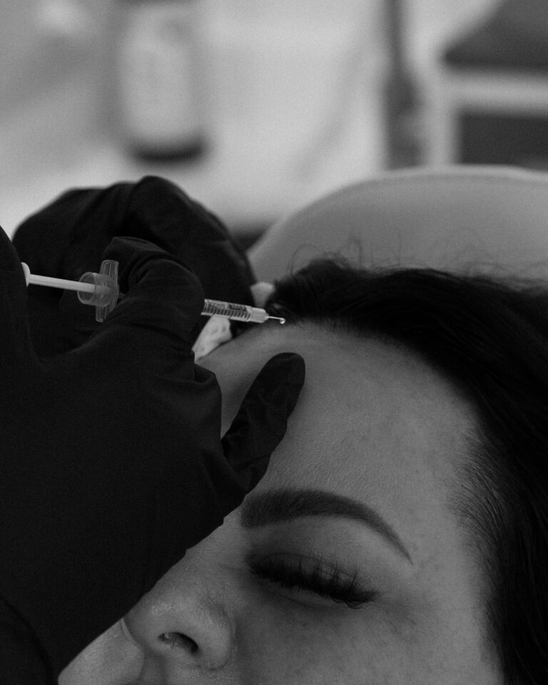 PRP Hair Restoration Port Coquitlam Port Moody Vancouver KOZA Skin Clinic