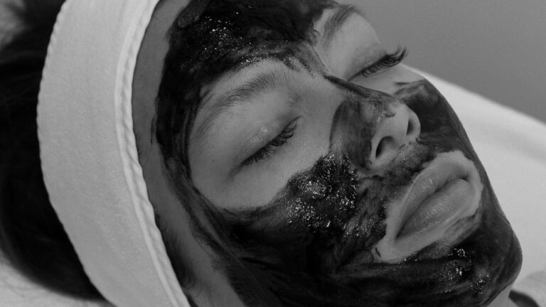 VCarbon System Carbon Charcoal Chemical Peel TCA Port Coquitlam Port Moody Vancouver KOZA Skin Clinic