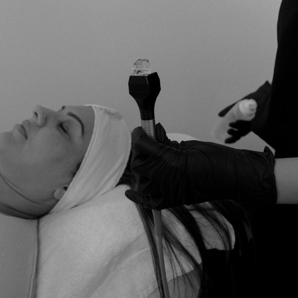 InMode Forma RF Radiofrequency Skin Tightening Port Coquitlam Port Moody Vancouver KOZA Skin Clinic