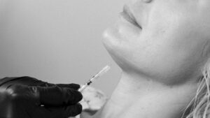 Fat Dissolve DCA Deoxycholic Acid Kybella Belkyra Lipodissolve Liquid Lipo Port Coquitlam Port Moody Vancouver KOZA Skin Clinic