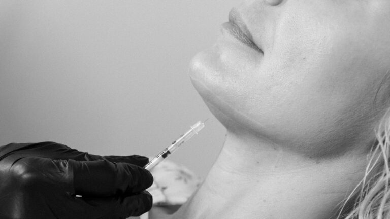 Fat Dissolve DCA Deoxycholic Acid Kybella Belkyra Lipodissolve Liquid Lipo Port Coquitlam Port Moody Vancouver KOZA Skin Clinic