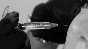 Dermal Filler Hyaluronic Acid Filler Port Coquitlam Port Moody Vancouver KOZA Skin Clinic