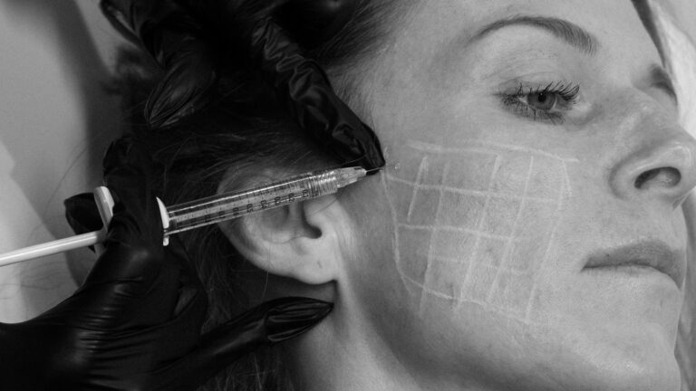SkinVive Skin Booster Volite Injectable Moisturizer Port Coquitlam Port Moody Vancouver KOZA Skin Clinic