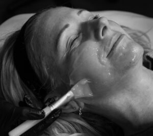 CO2 treatment, CO2Lift Pro Mask, Carboxy Gel Therapy, Port Coquitlam Port Moody Vancouver KOZA Skin Clinic