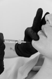 Facial Balancing Dermal Filler Experts Port Coquitlam TriCities by KOZA Skin Clinic