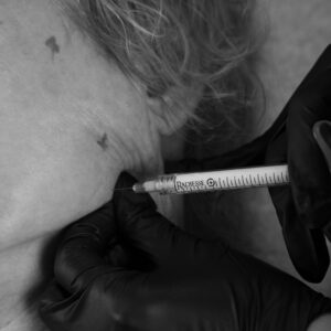 Reverse Aging in Layers